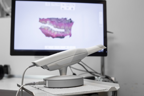 CEREC Crowns Compared To Other Restorations