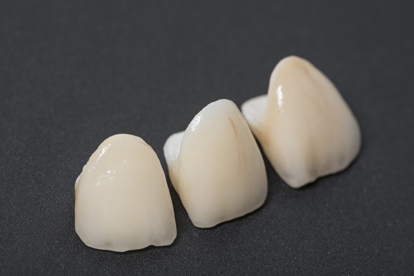 A Step By Step Look Into How CEREC Crowns Are Made